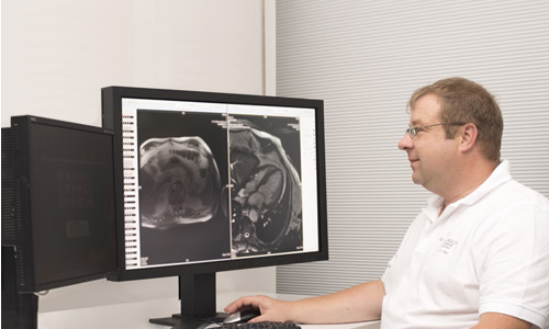 Kardiale Kernspintomographie (Kardio-MRT)
